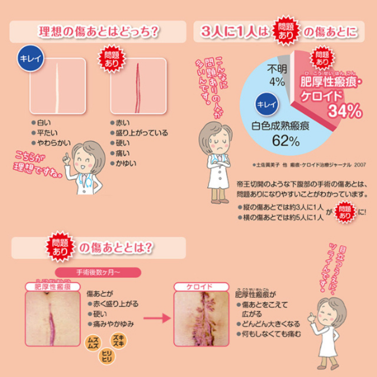 レディケア ナチュラル UVカット 8