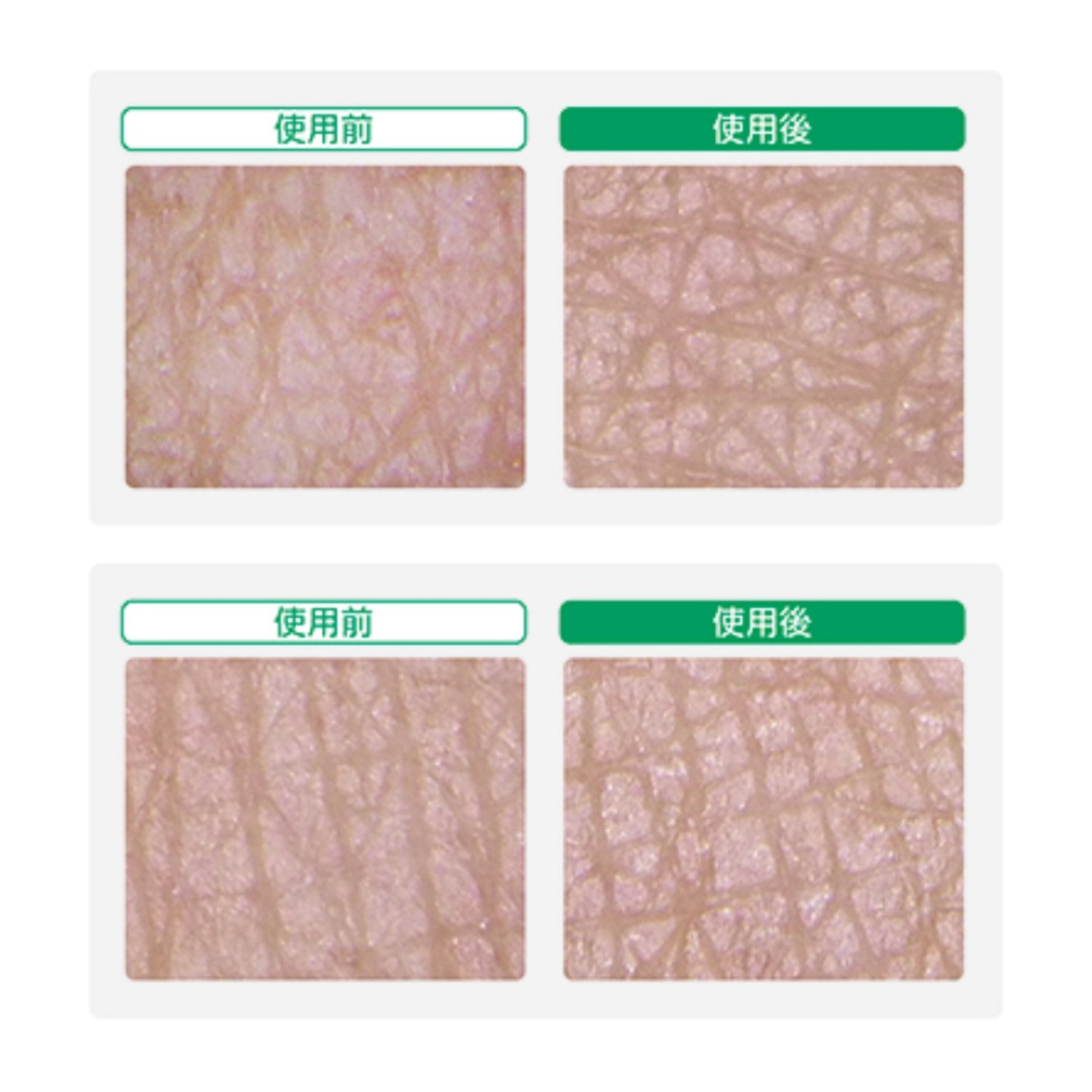 リモイスラメラ保湿ミルク 150ml 150ml ミニ