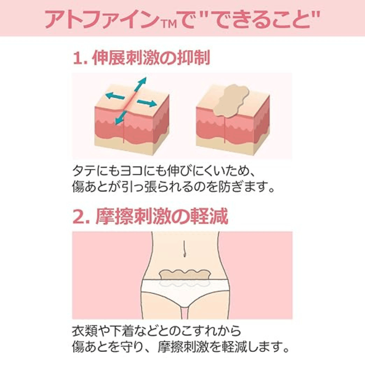 アトファイン Mサイズ 5箱セット(30枚) Mサイズ